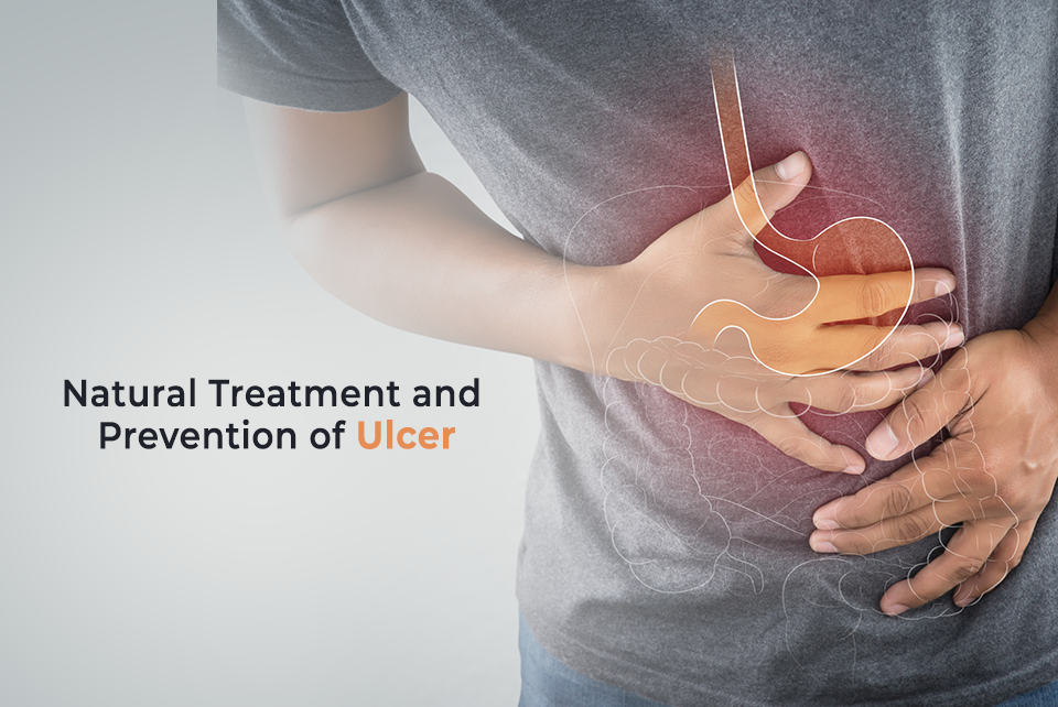 Natural-Treatment-and-Prevention-of-Ulcer